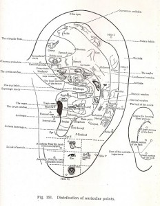 auriculo theraphy 1